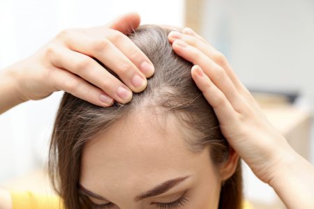 Telogen effluvium men -Telogen Hair Loss: Causes and Treatment Options