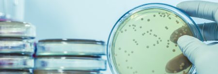 Legionella Testing Market