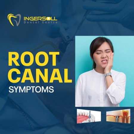 Root Canal Symptoms