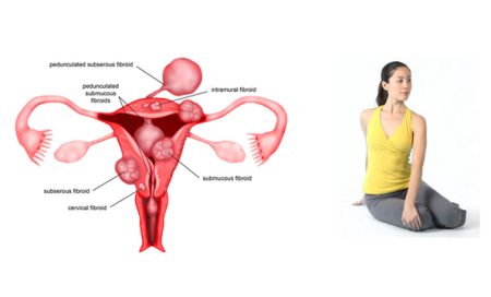 To keep the uterus healthy, women must do these yoga asanas