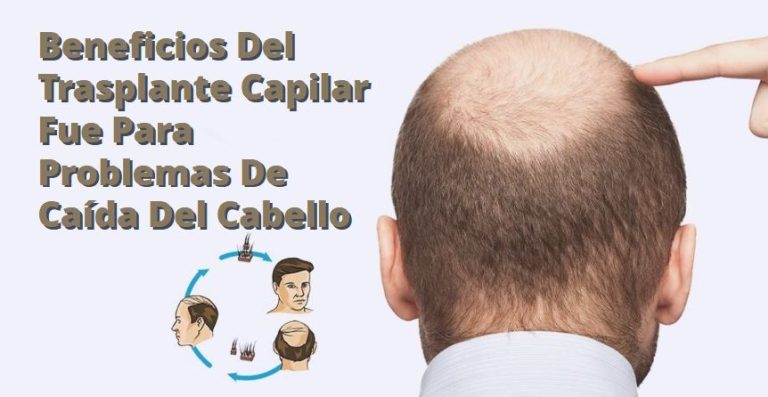 transplante de cabello