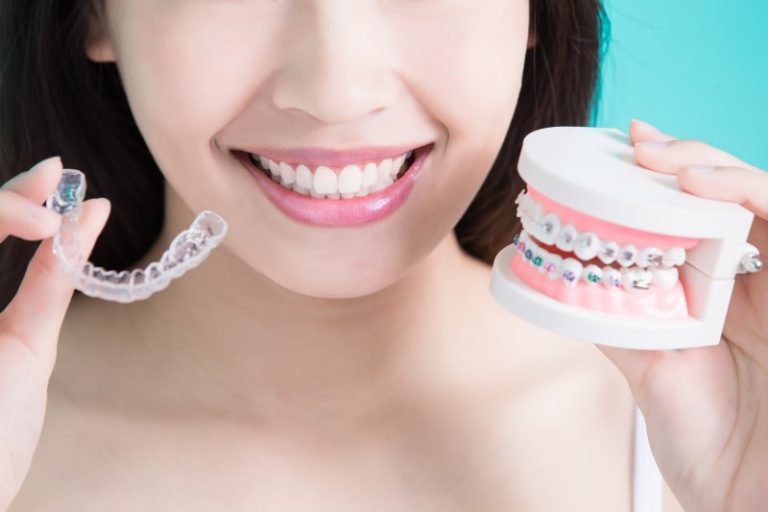 Invisalign Toronto