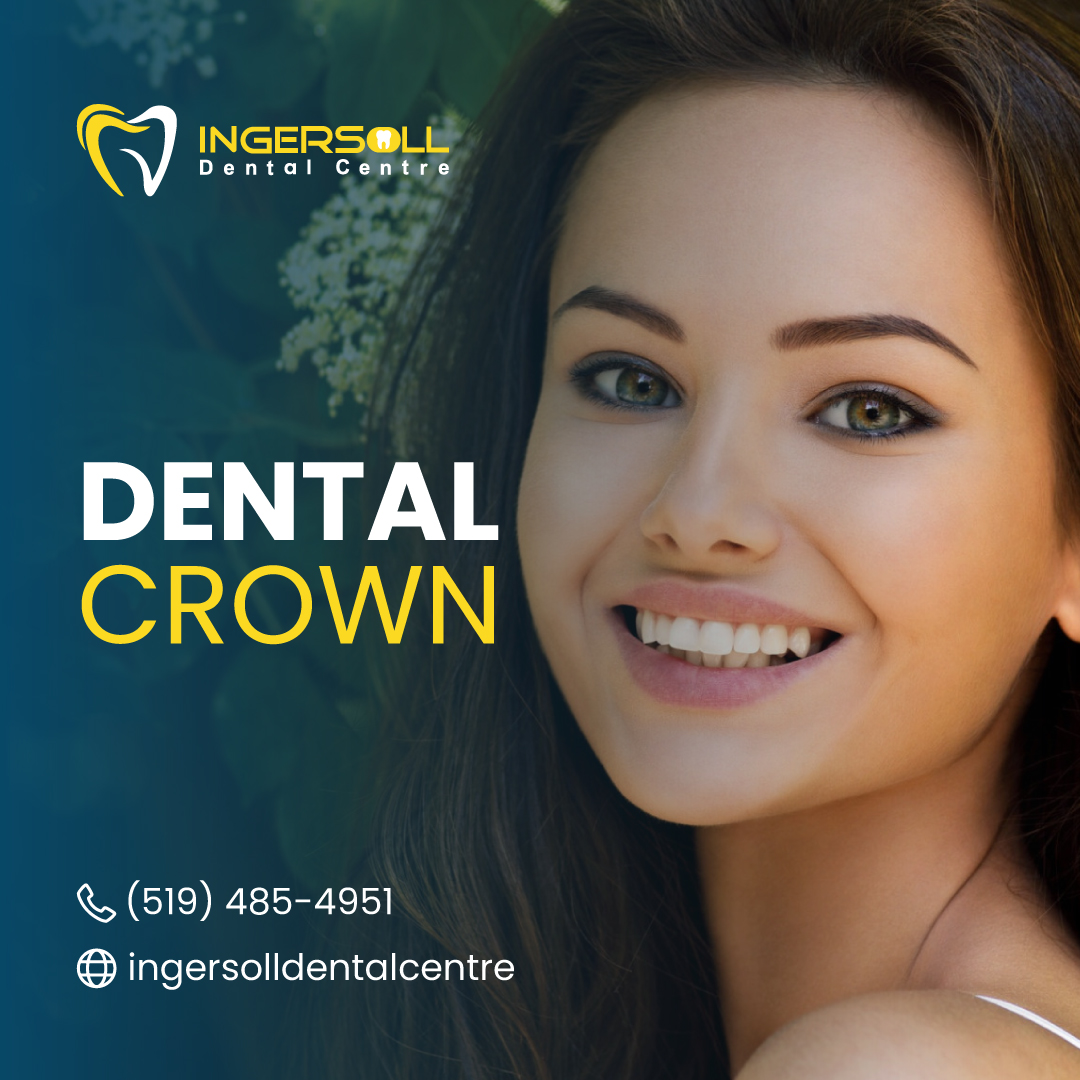 dental crown cost canada