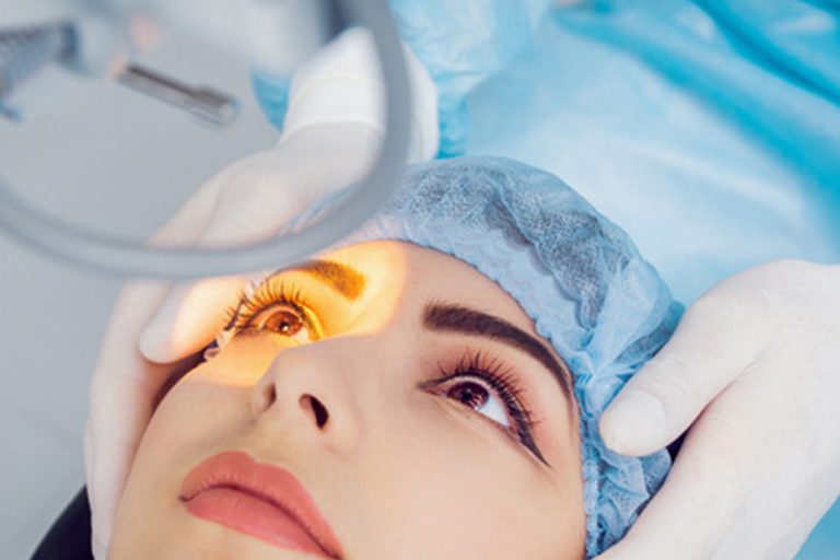 LASIK-Eye-Surgery