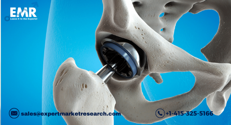 Orthopaedic Digit Implants Market