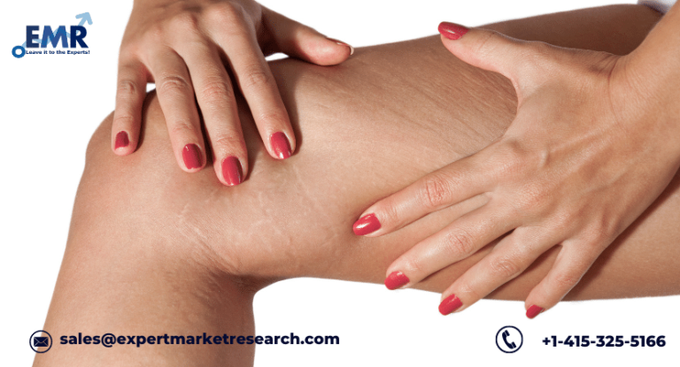 Stretch Marks Treatment Market