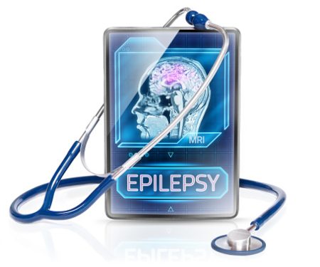 Epilepsy Monitoring Devices Market