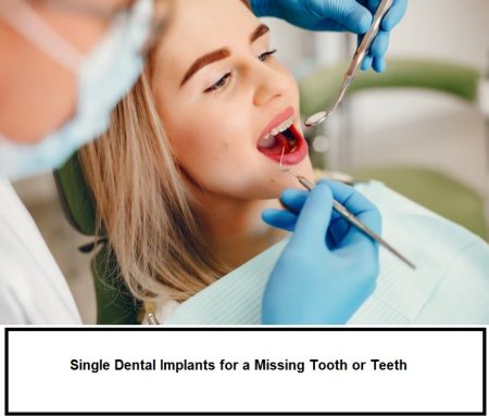 dental implants Calgary, AB