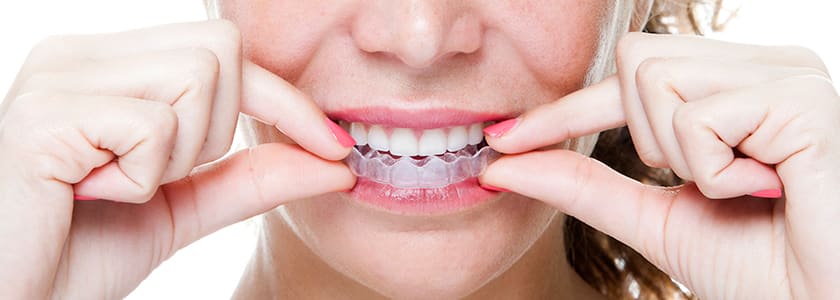 invisalign cost Toronto